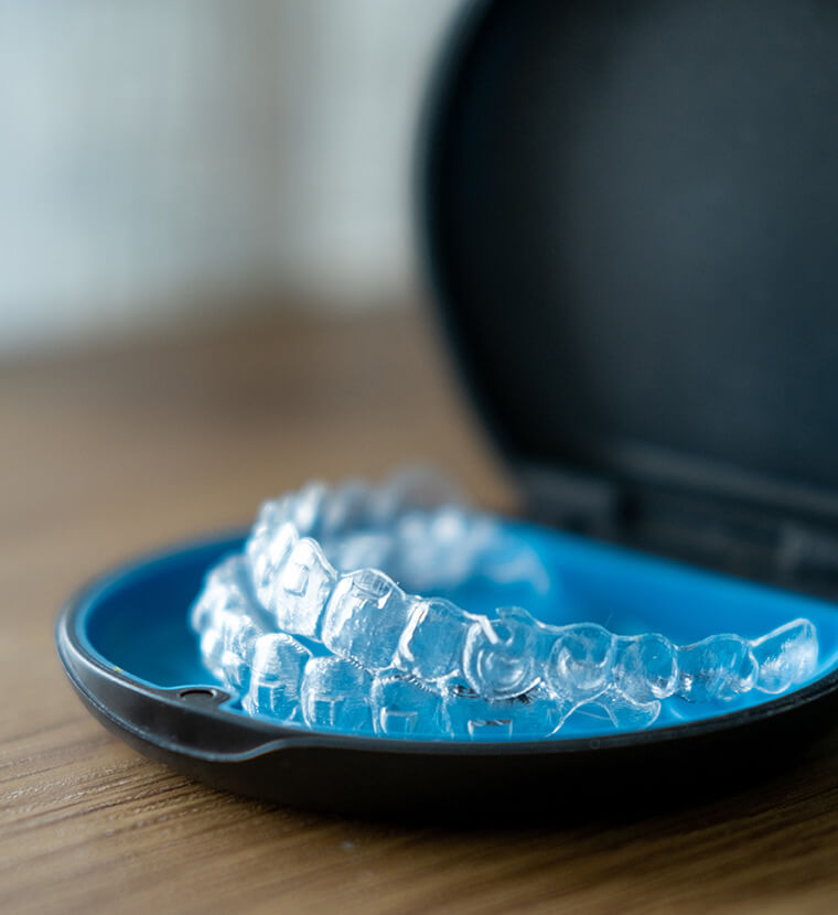 clear aligners